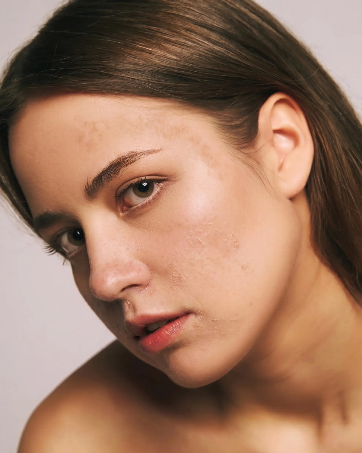 Skin before using Auri Honey Balm